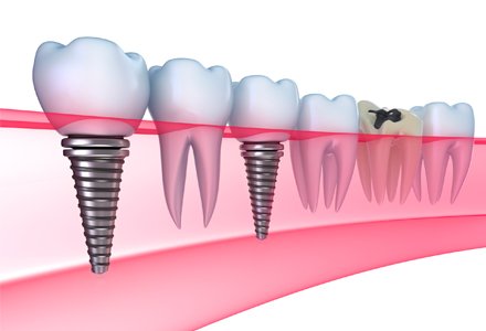 Fairfield Dentists